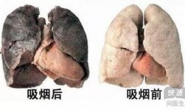 肺癌晚期的人吃茄瓜,茄瓜助力肺癌晚期患者营养补充与康复