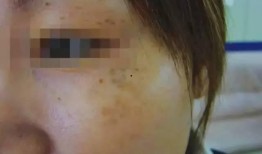 痣瓜怎么吃最好,解锁健康美味新体验