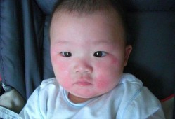 小孩吃角瓜过敏吗,过敏风险知多少？