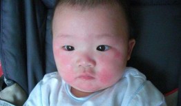 小孩吃角瓜过敏吗,过敏风险知多少？