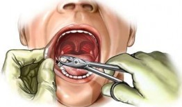 拔牙吃瓜的视频,网友直呼太解压！